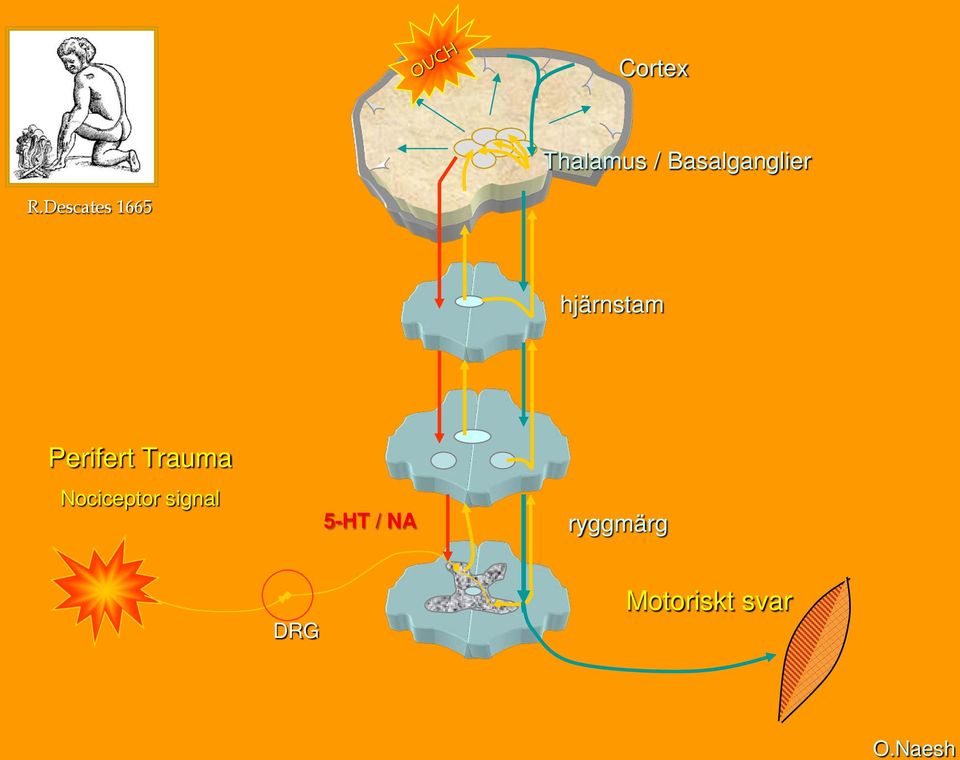 Perifert Trauma Nociceptor