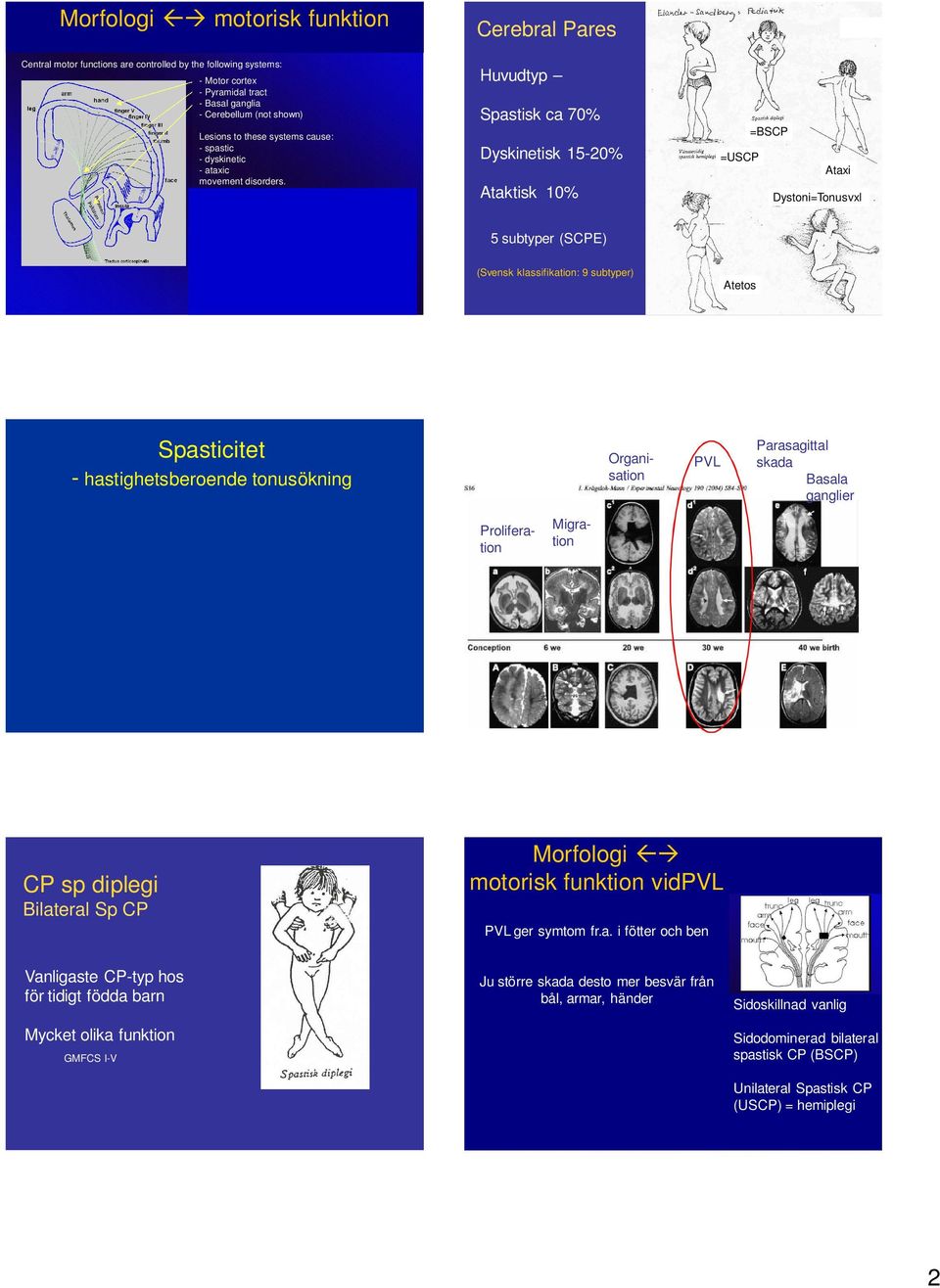Sidoskillnad The assumption thus vanlig must be, that the brain lesions, which are found in 7-8 of CP-children, are affecting the respective system according to Sidodominerad the neurological subtype.