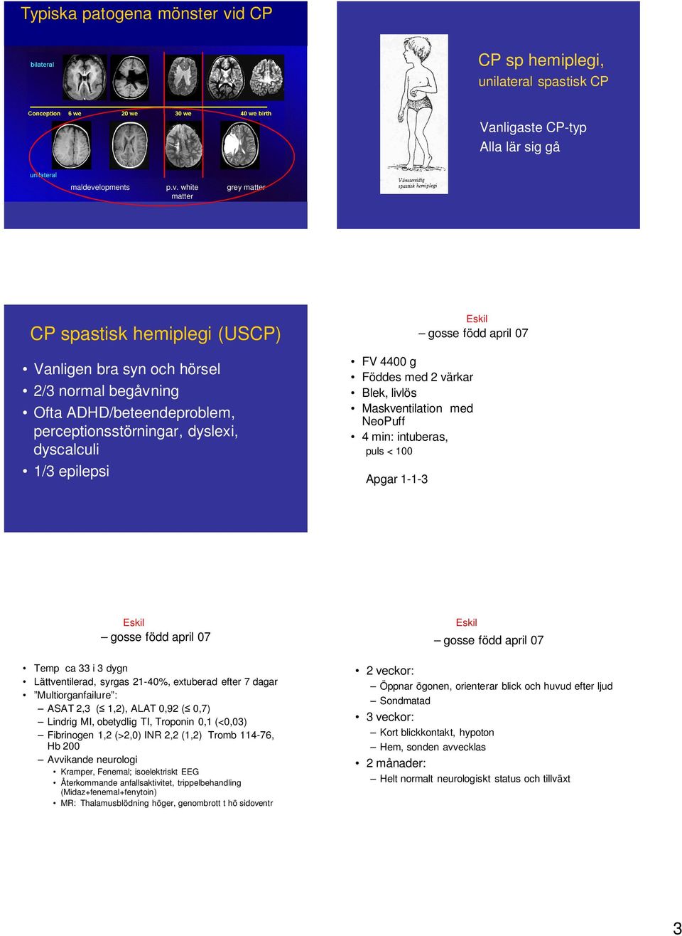 involves the motor system, thus explains uni- or bilateral neurology and motor dysfunction BACK CP sp hemiplegi, unilateral spastisk CP Vanligaste CP-typ Alla lär sig gå maldevelopments p.v. white