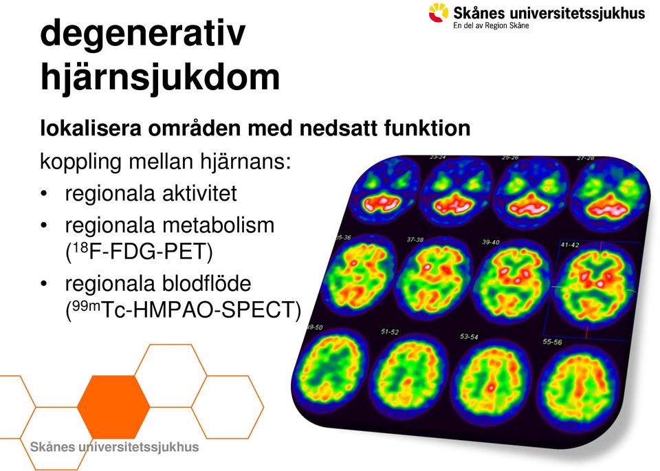 aktivitet regionala metabolism ( 18 F-FDG-PET)