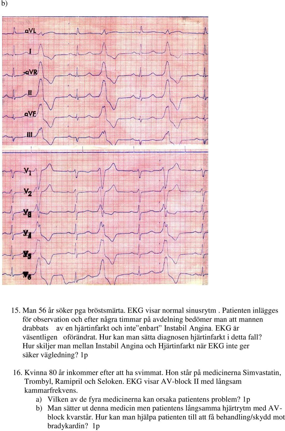 Hur kan man sätta diagnosen hjärtinfarkt i detta fall? Hur skiljer man mellan Instabil Angina och Hjärtinfarkt när EKG inte ger säker vägledning? 1p 16. Kvinna 80 år inkommer efter att ha svimmat.