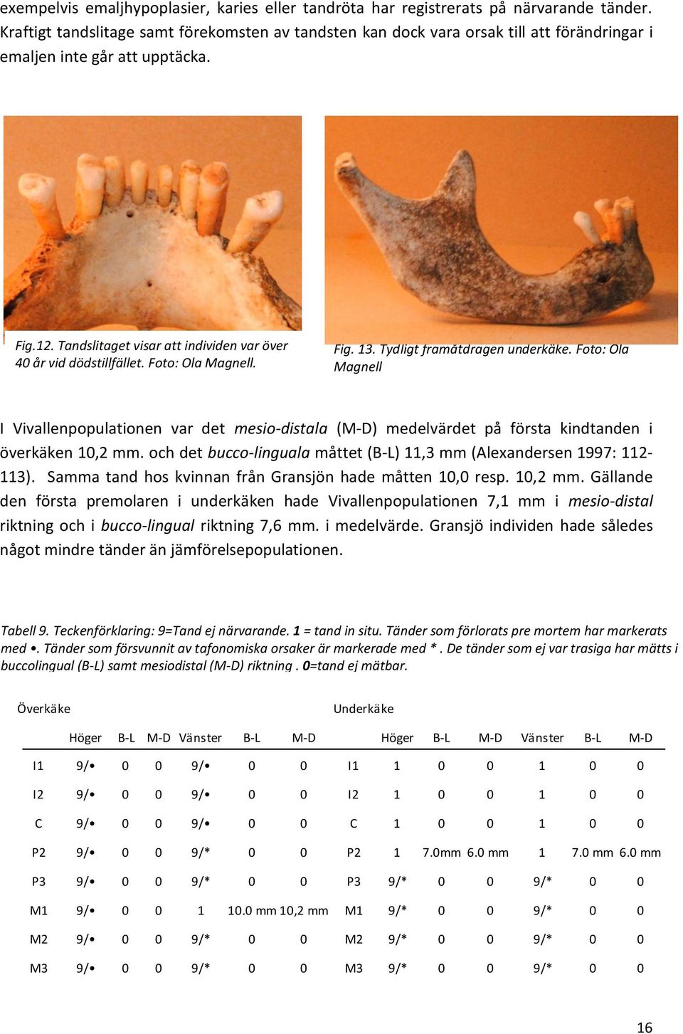 Foto: Ola Magnell. Fig. 13. Tydligt framåtdragen underkäke. Foto: Ola Magnell I Vivallenpopulationen var det mesio-distala (M-D) medelvärdet på första kindtanden i överkäken 10,2 mm.