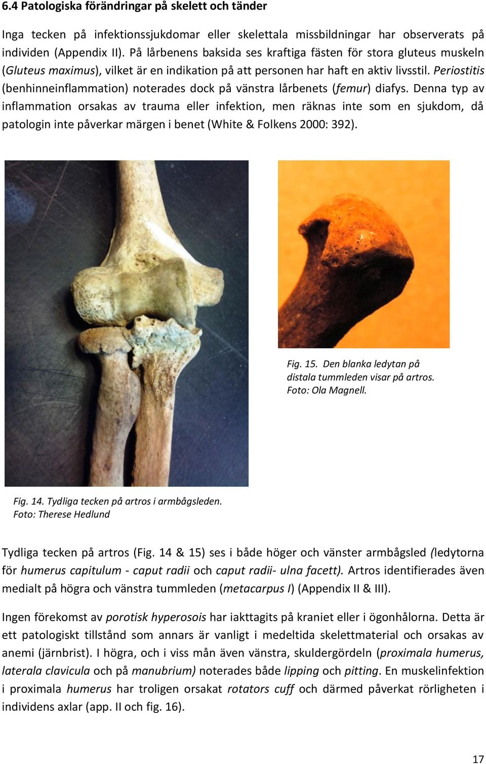 Periostitis (benhinneinflammation) noterades dock på vänstra lårbenets (femur) diafys.