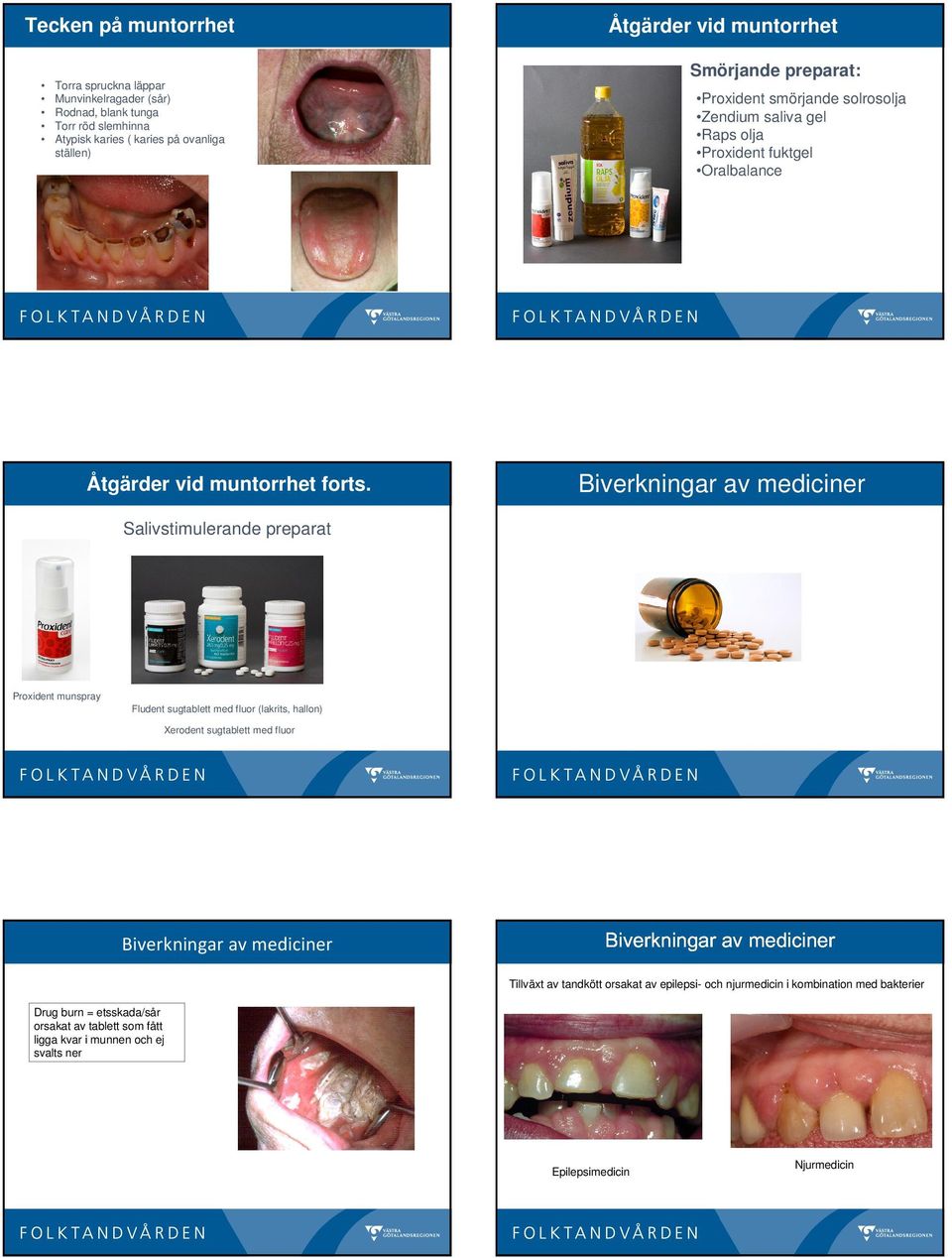 Biverkningar av mediciner Salivstimulerande preparat Proxident munspray Fludent sugtablett med fluor (lakrits, hallon) Xerodent sugtablett med fluor Biverkningar av mediciner