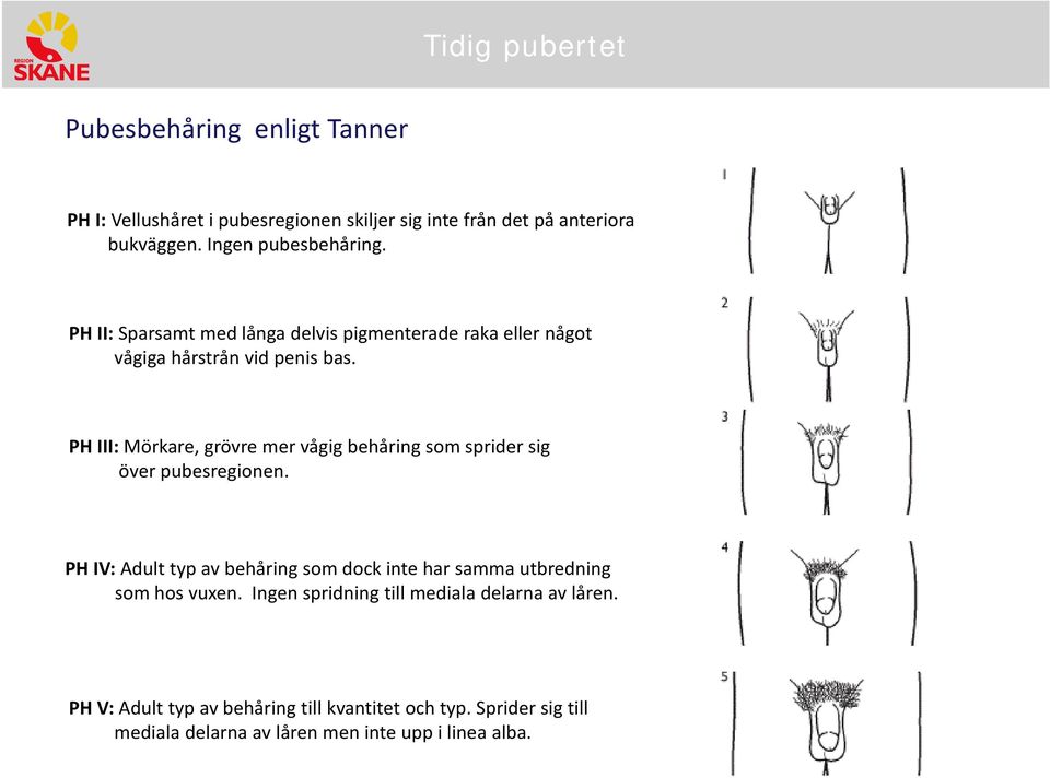 PH III: Mörkare, grövre mer vågig behåring som sprider sig över pubesregionen.