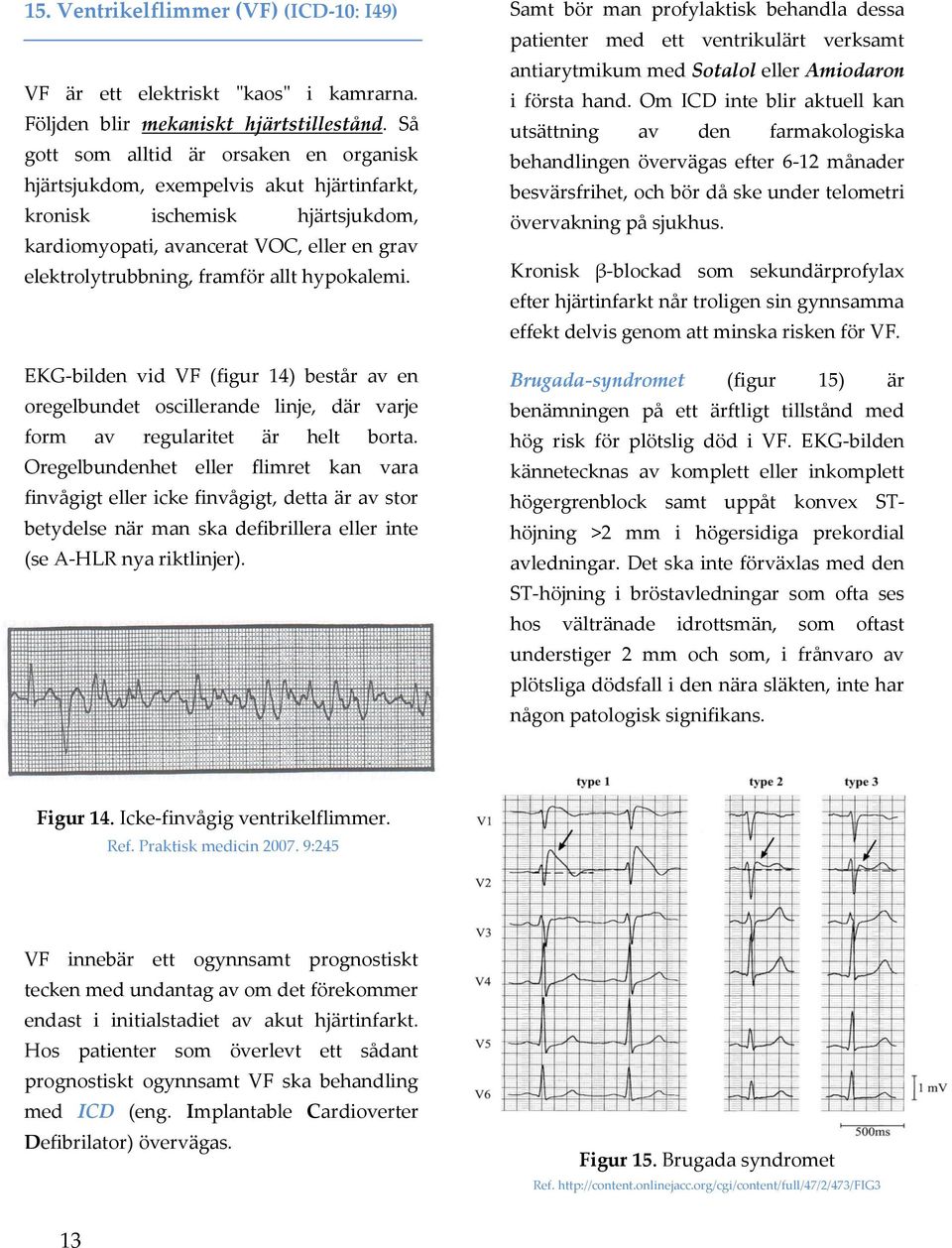 hypokalemi. EKG-bilden vid VF (figur 14) består av en oregelbundet oscillerande linje, där varje form av regularitet är helt borta.