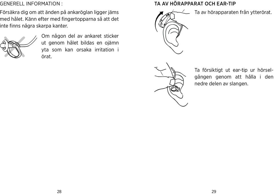 hålet bildas en ojämn yta som kan orsaka irritation i örat Ta av hörapparat och ear-tip Ta av