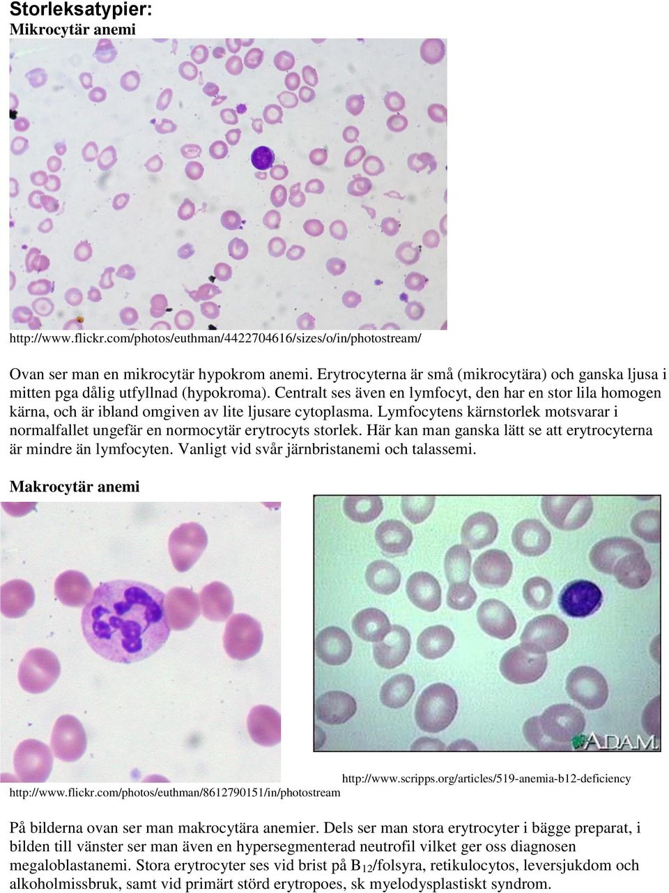 Centralt ses även en lymfocyt, den har en stor lila homogen kärna, och är ibland omgiven av lite ljusare cytoplasma.