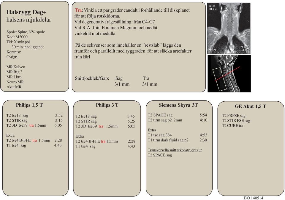 A: från Foramen Magnum och nedåt, vinkelrät mot medulla På de sekvenser som innehåller en restslab läggs den framför och parallellt med ryggraden för att släcka artefakter från kärl Snittjocklek/Gap: