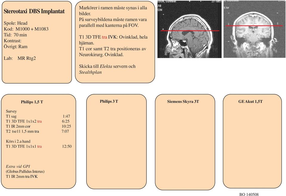 T1 cor samt T2 tra positioneras av Neurokirurg. Ovinklad.