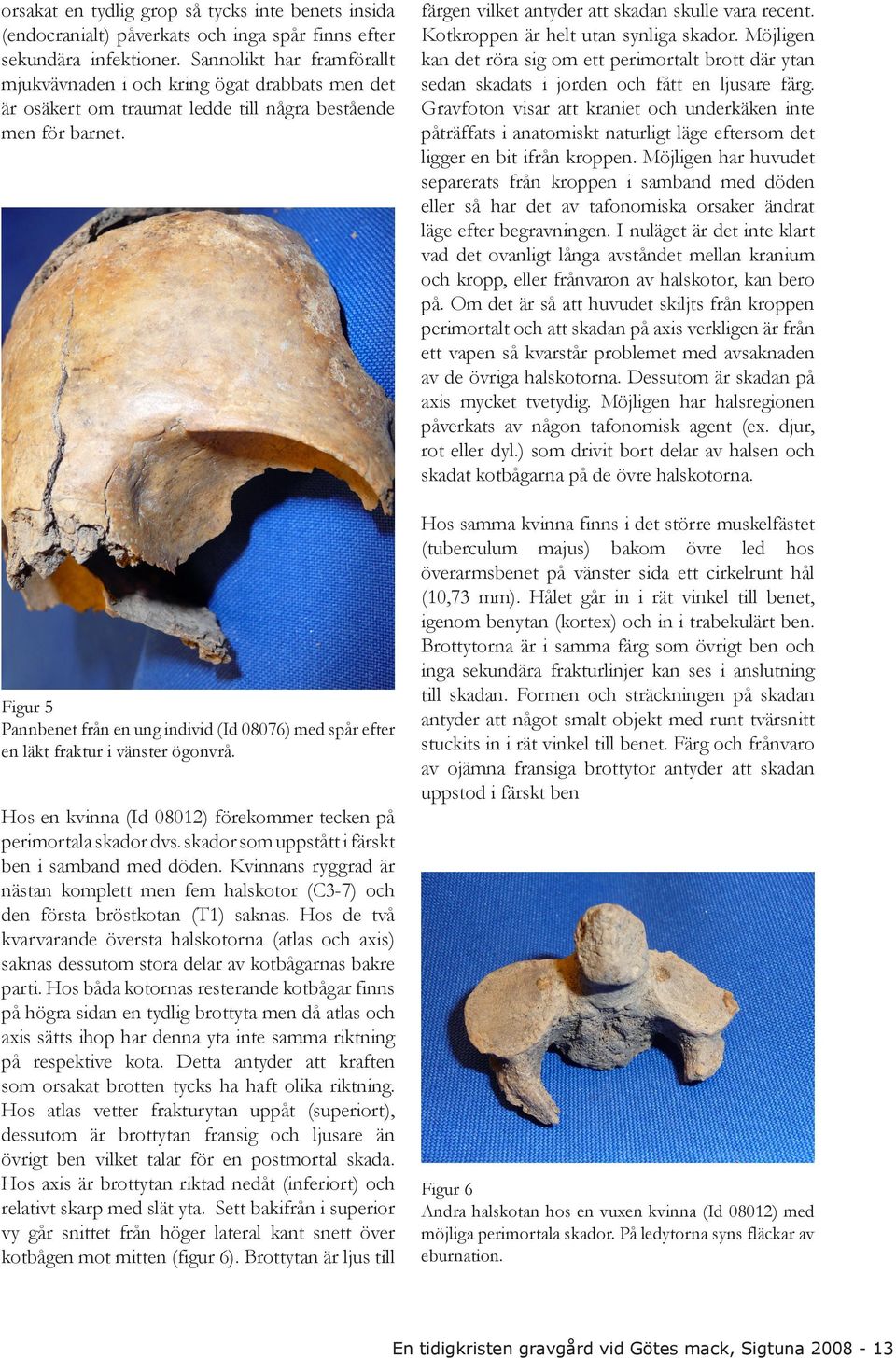 Figur 5 Pannbenet från en ung individ (Id 08076) med spår efter en läkt fraktur i vänster ögonvrå. Hos en kvinna (Id 08012) förekommer tecken på perimortala skador dvs.
