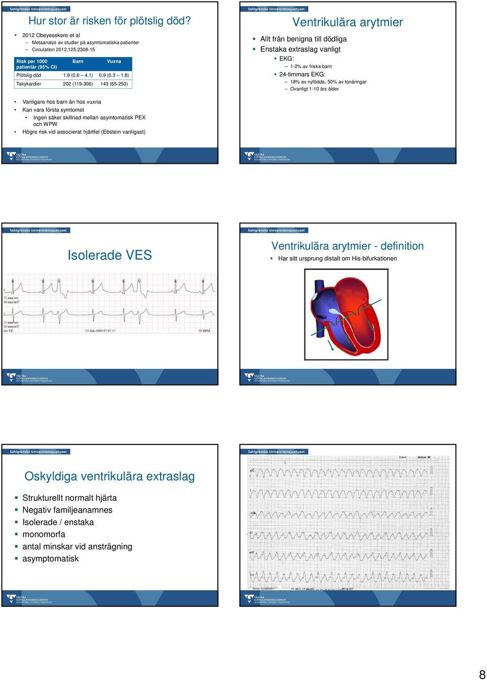 8) Takykardier k 202 (119-306) 143 (65-250) Ventrikulära arytmier Allt från benigna till dödliga Enstaka extraslag vanligt EKG: 1-2% av friska barn 24-timmars EKG: 18% av nyfödda, 50% av tonåringar