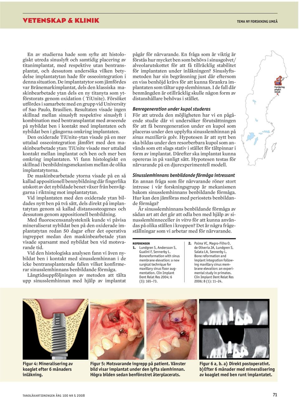 De implantatytor som jämfördes var Brånemarkimplantat, dels den klassiska maskinbearbetade ytan dels en ny titanyta som ytförstorats genom oxidation ( TiUnite).