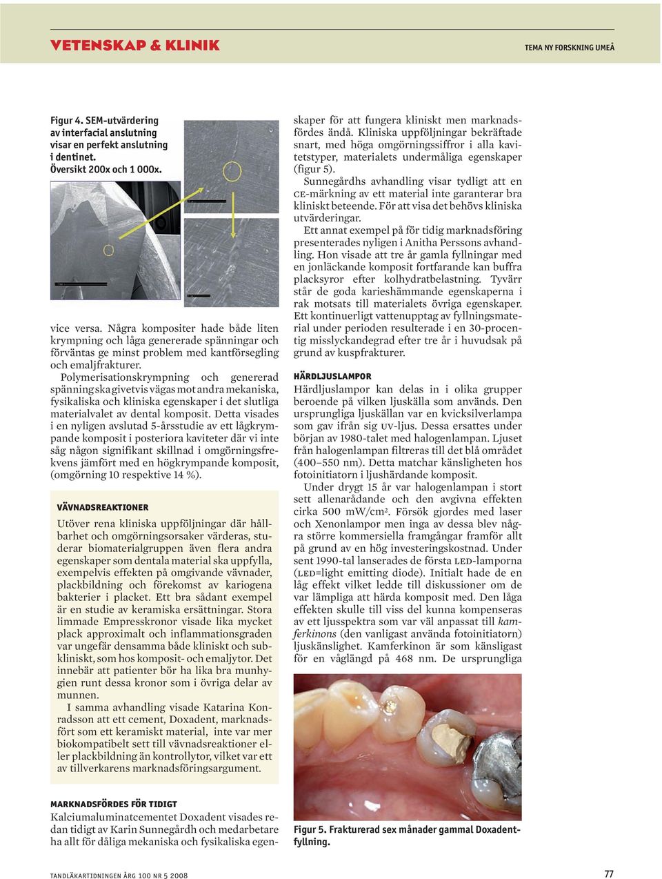 Polymerisationskrympning och genererad spänning ska givetvis vägas mot andra mekaniska, fysikaliska och kliniska egenskaper i det slutliga materialvalet av dental komposit.