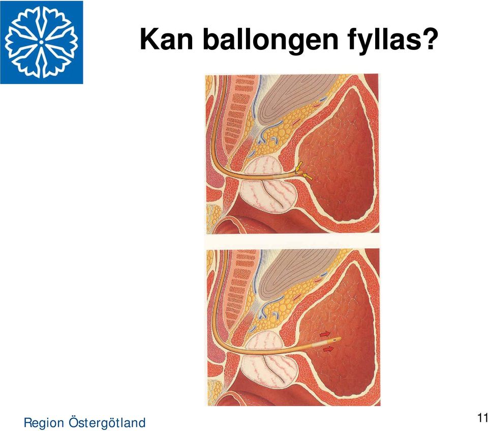 fyllas?