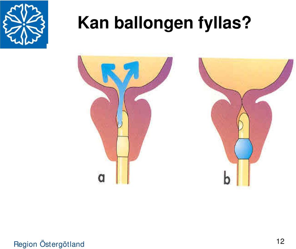 fyllas?