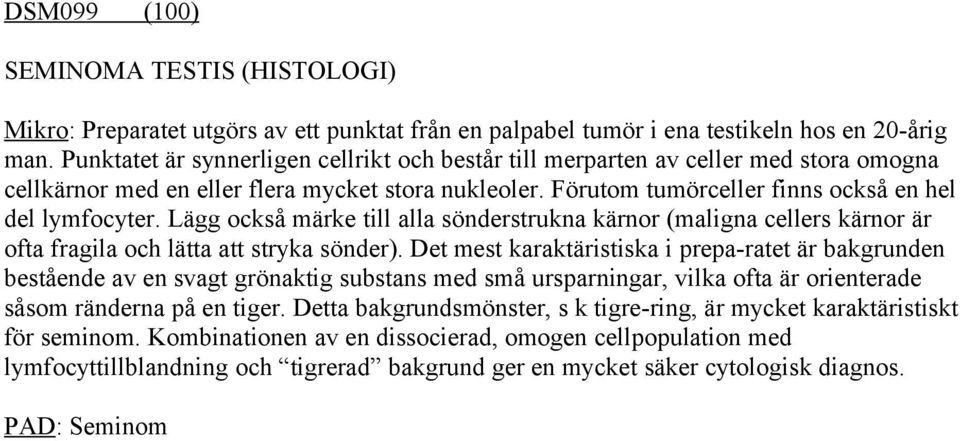 Lägg också märke till alla sönderstrukna kärnor (maligna cellers kärnor är ofta fragila och lätta att stryka sönder).