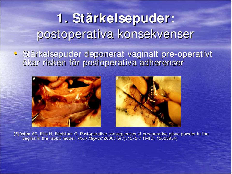 (Sjösten AC, Ellis H, Edelstam G.