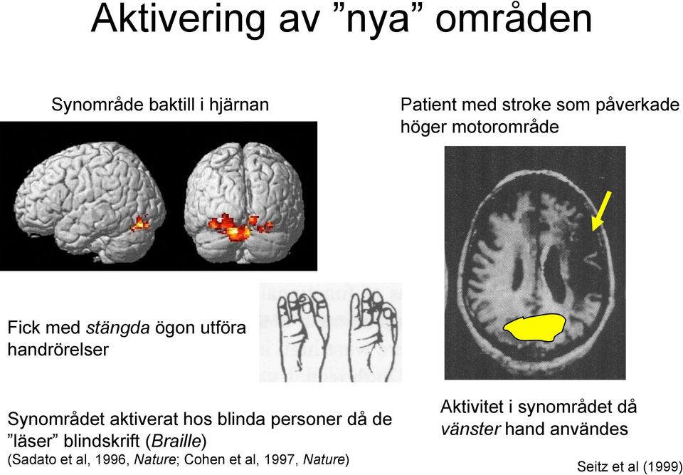 aktiverat hos blinda personer då de läser blindskrift (Braille) (Sadato et al, 1996,