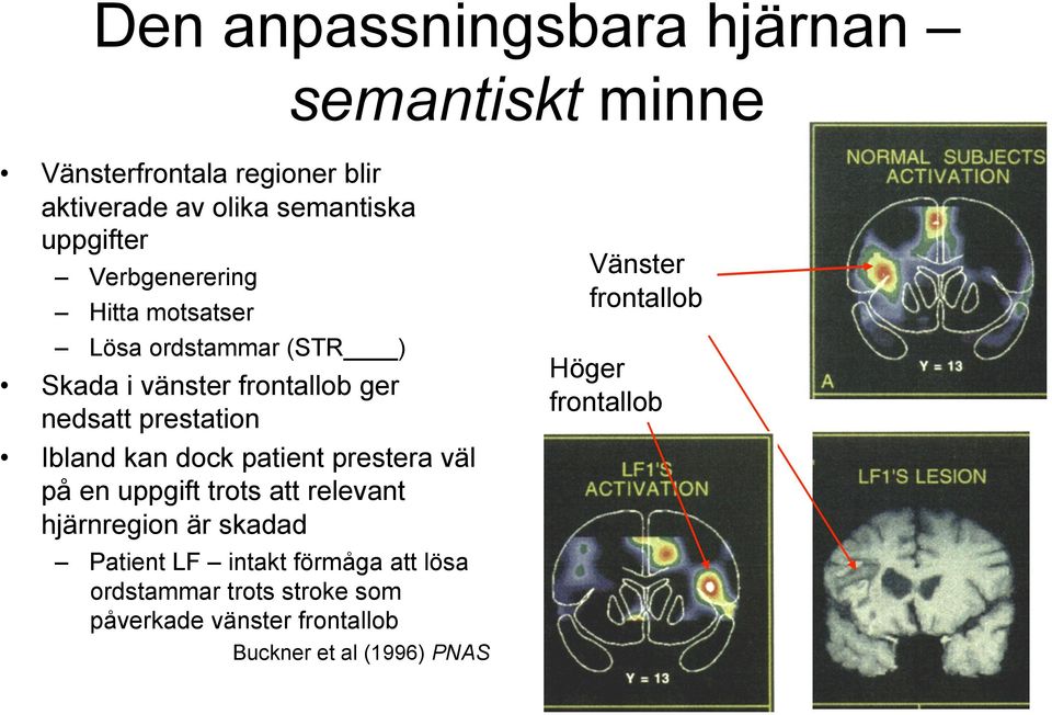 dock patient prestera väl på en uppgift trots att relevant hjärnregion är skadad Patient LF intakt förmåga att lösa