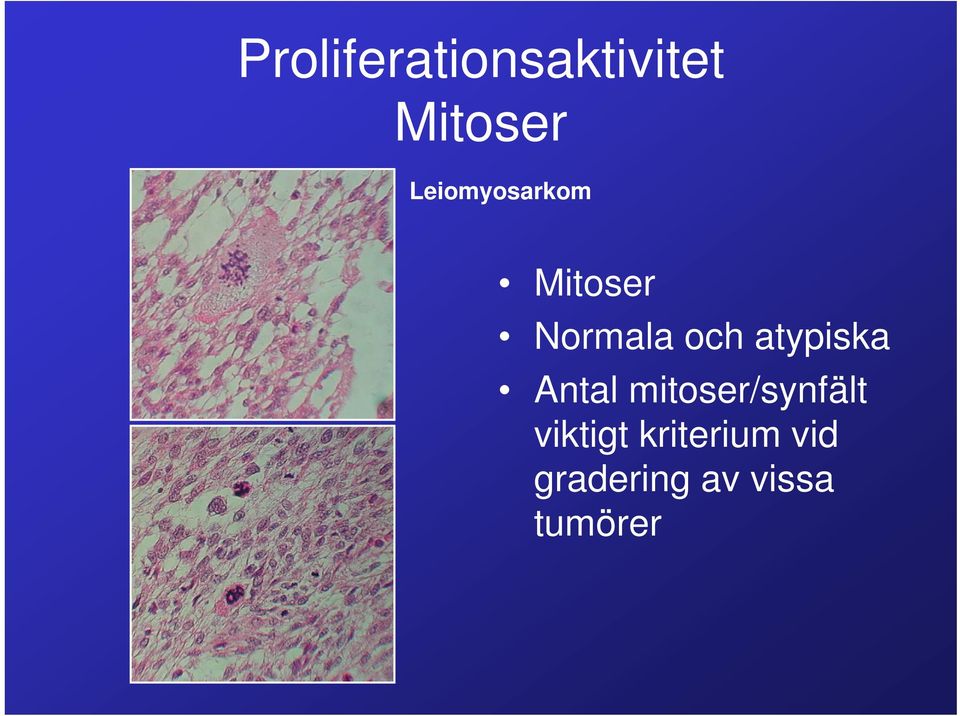 atypiska Antal mitoser/synfält