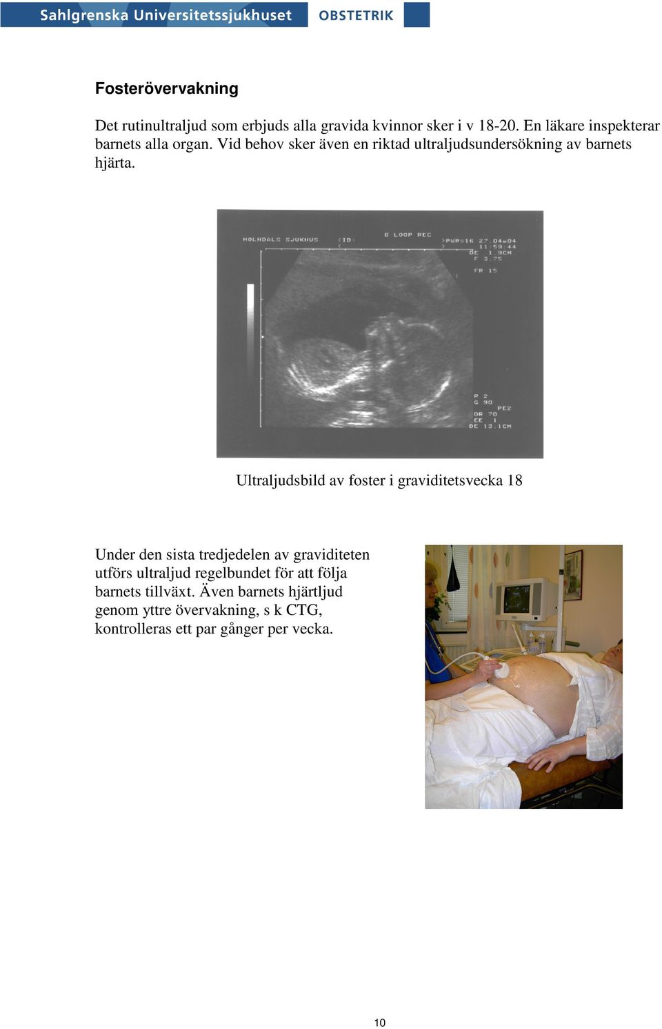 Ultraljudsbild av foster i graviditetsvecka 18 Under den sista tredjedelen av graviditeten utförs ultraljud
