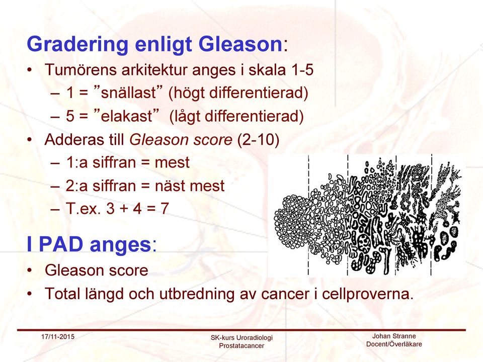 score (2-10) 1:a siffran = mest 2:a siffran = näst mest T.ex.