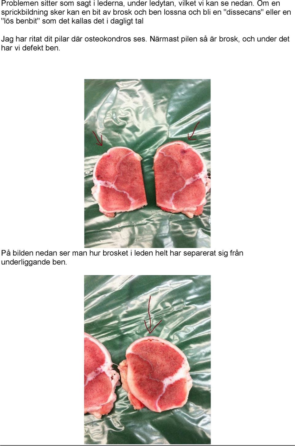 benbit" som det kallas det i dagligt tal Jag har ritat dit pilar där osteokondros ses.