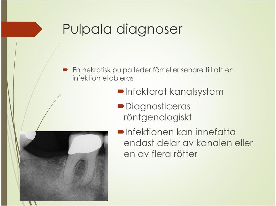 infektion etableras Infekterat kanalsystem