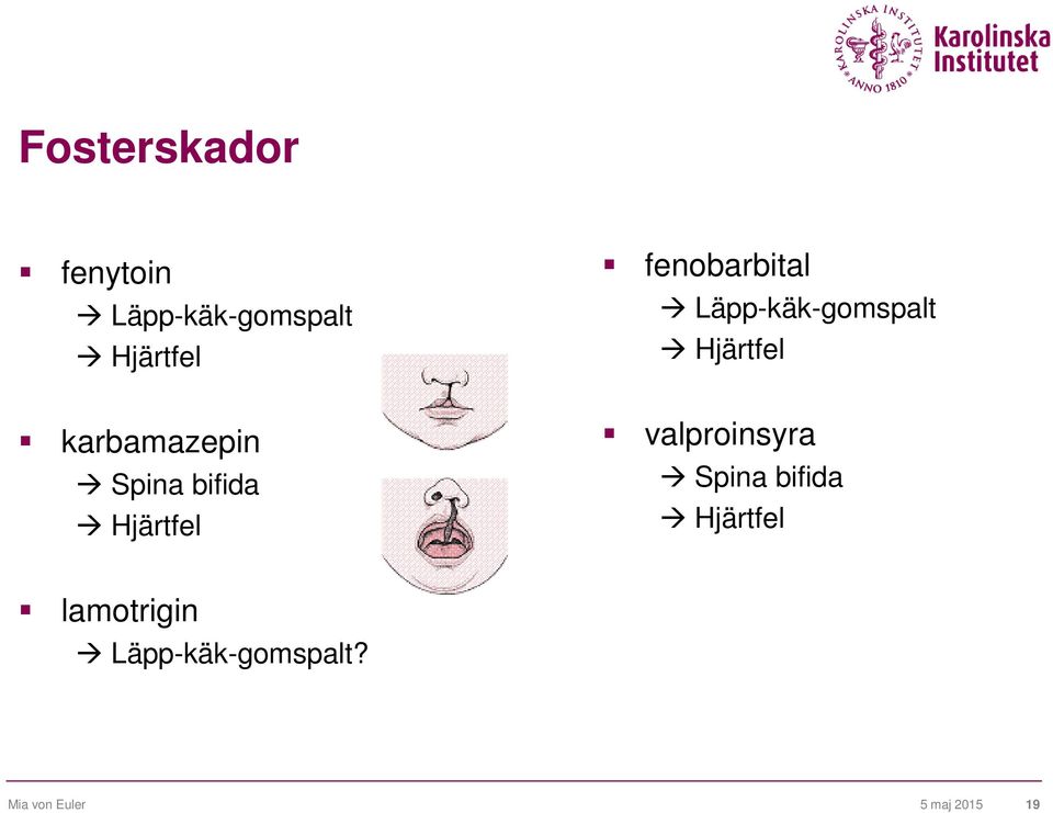 Läpp-käk-gomspalt Hjärtfel valproinsyra Spina bifida