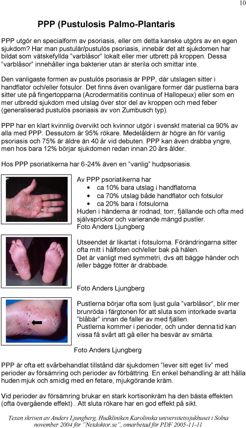 Dessa varblåsor innehåller inga bakterier utan är sterila och smittar inte. Den vanligaste formen av pustulös psoriasis är PPP, där utslagen sitter i handflator och/eller fotsulor.