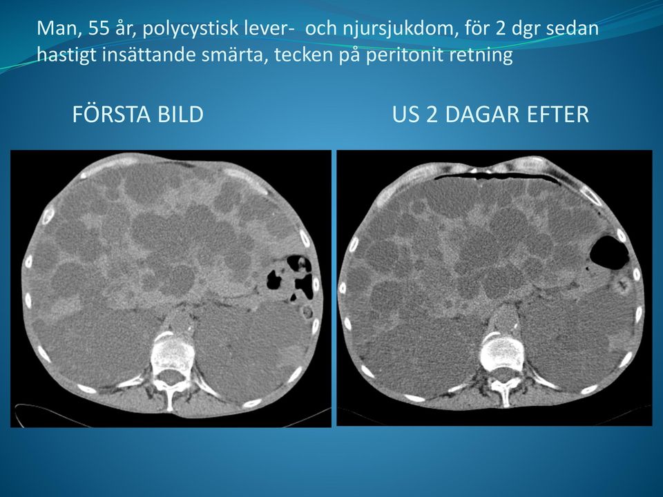 insättande smärta, tecken på