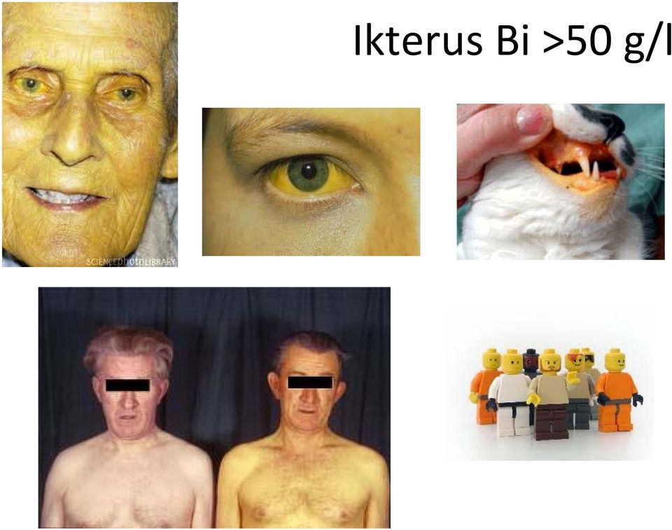 g/l