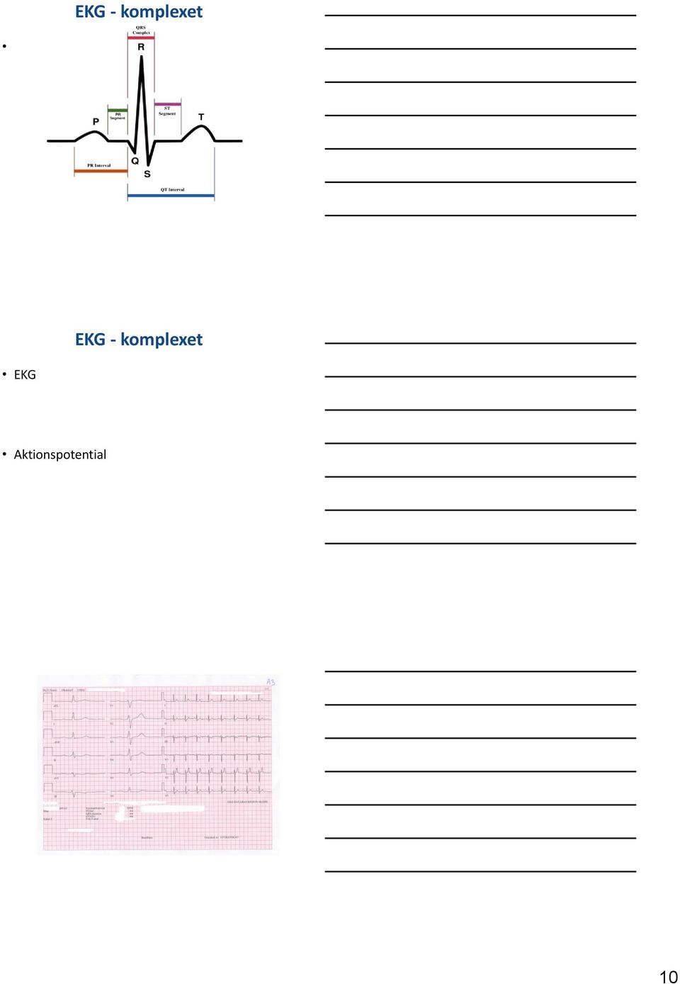 EKG