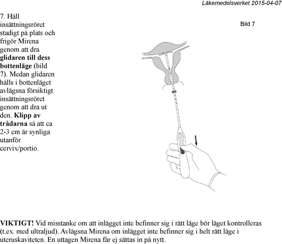 Klipp av trådarna så att ca 2-3 cm är synliga utanför cervix/portio. Bild 7 VIKTIGT!