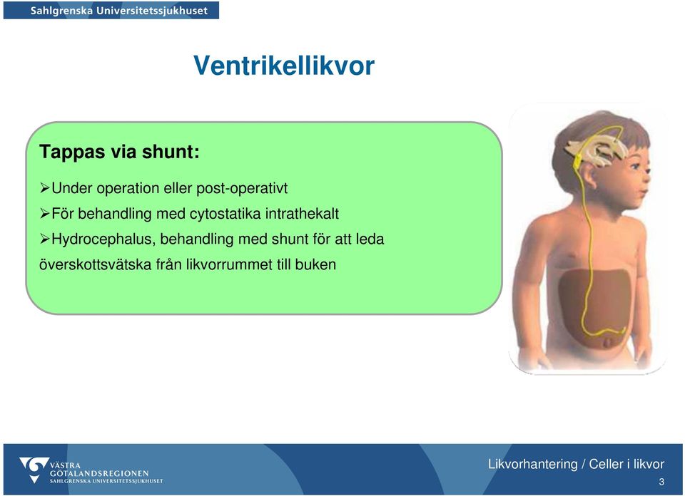 intrathekalt Hydrocephalus, behandling med shunt för