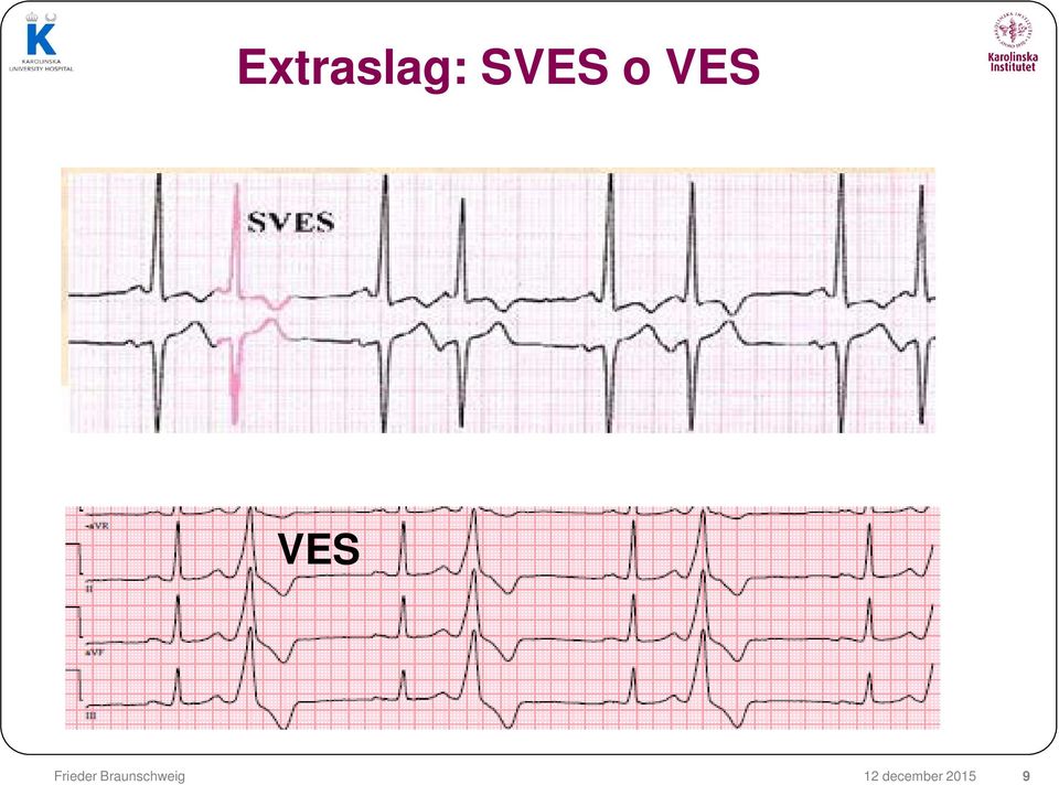 VES 12