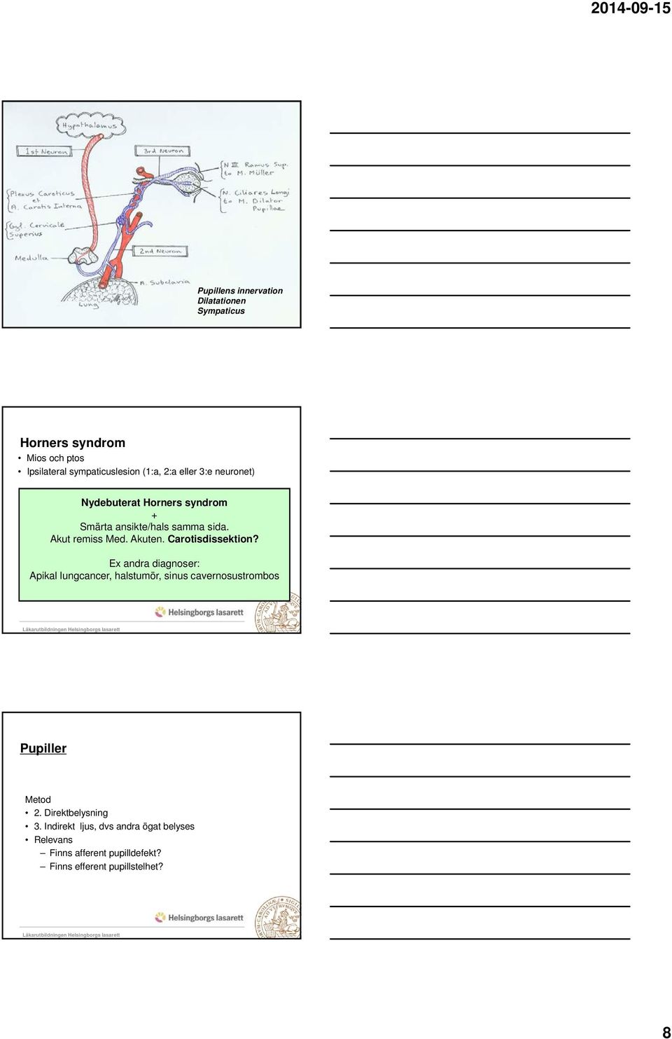 Carotisdissektion? Ex andra diagnoser: Apikal lungcancer, halstumör, sinus cavernosustrombos Pupiller Metod 2.