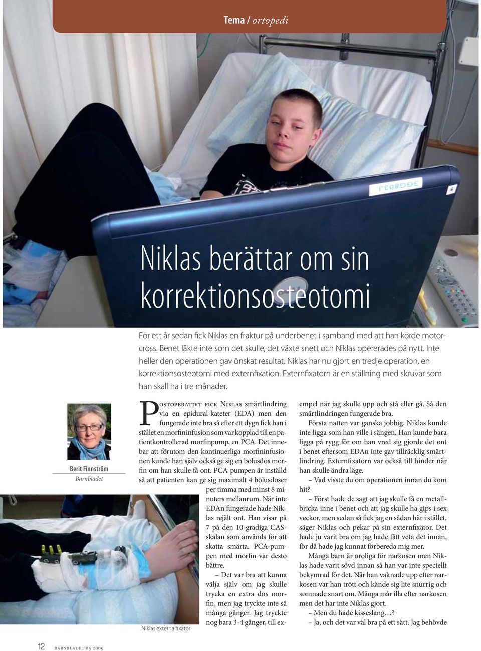 Niklas har nu gjort en tredje operation, en korrektionsosteotomi med externfixation. Externfixatorn är en ställning med skruvar som han skall ha i tre månader.