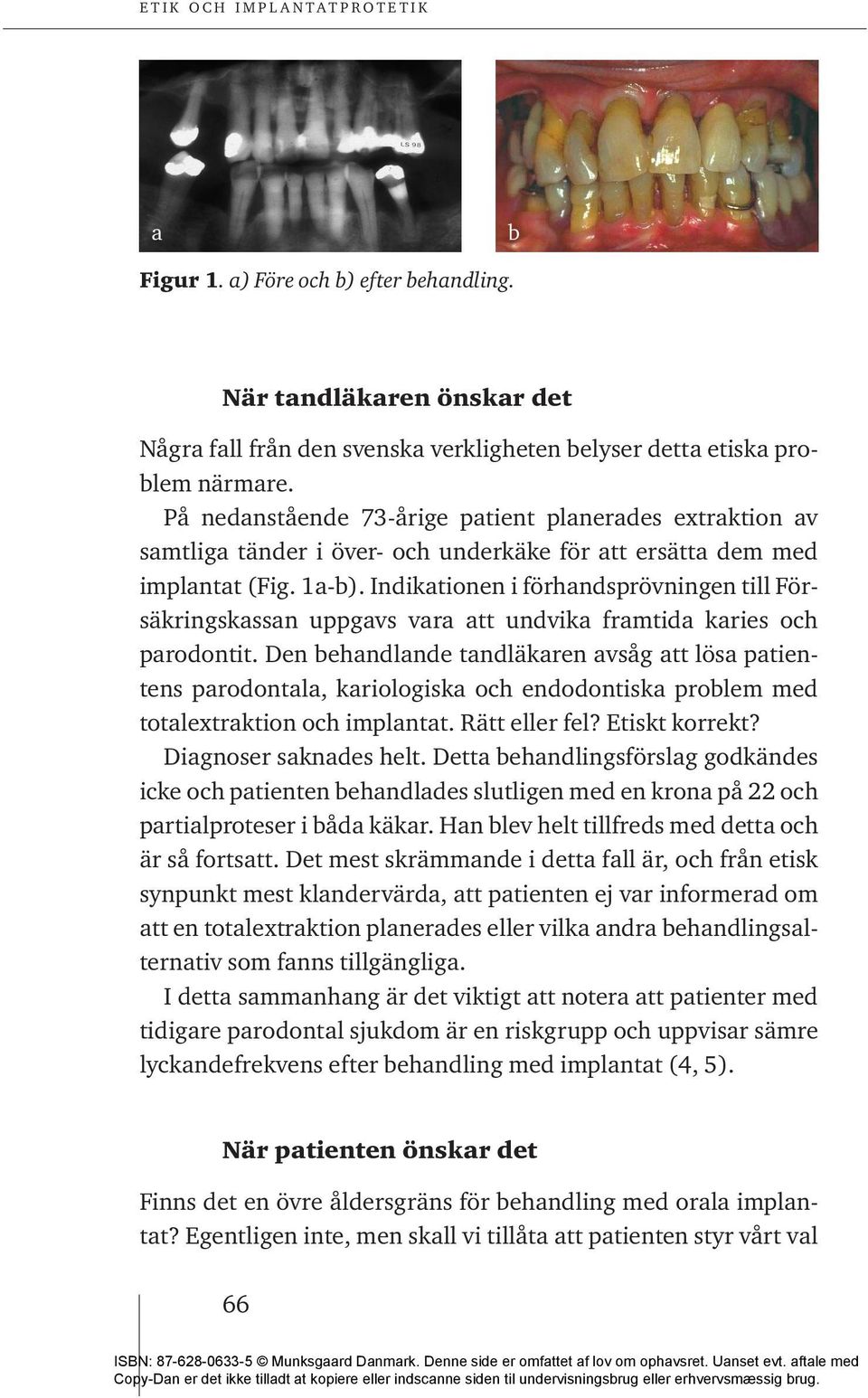 Indikationen i förhandsprövningen till Försäkringskassan uppgavs vara att undvika framtida karies och parodontit.