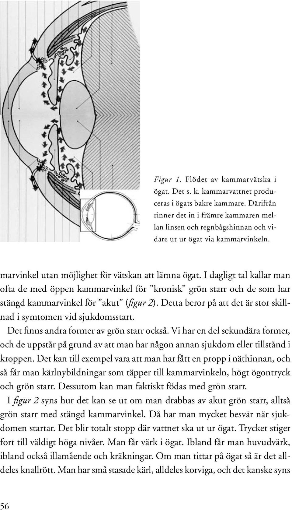 I dagligt tal kallar man ofta de med öppen kammarvinkel för kronisk grön starr och de som har stängd kammarvinkel för akut (figur 2).
