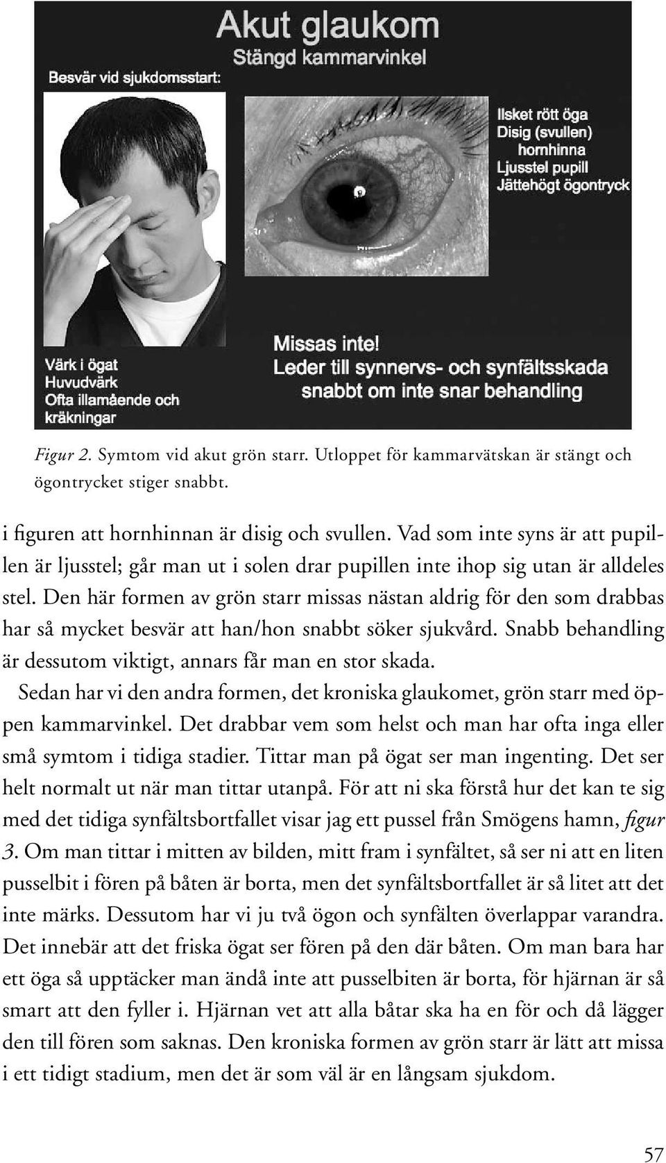 Den här formen av grön starr missas nästan aldrig för den som drabbas har så mycket besvär att han/hon snabbt söker sjukvård. Snabb behandling är dessutom viktigt, annars får man en stor skada.