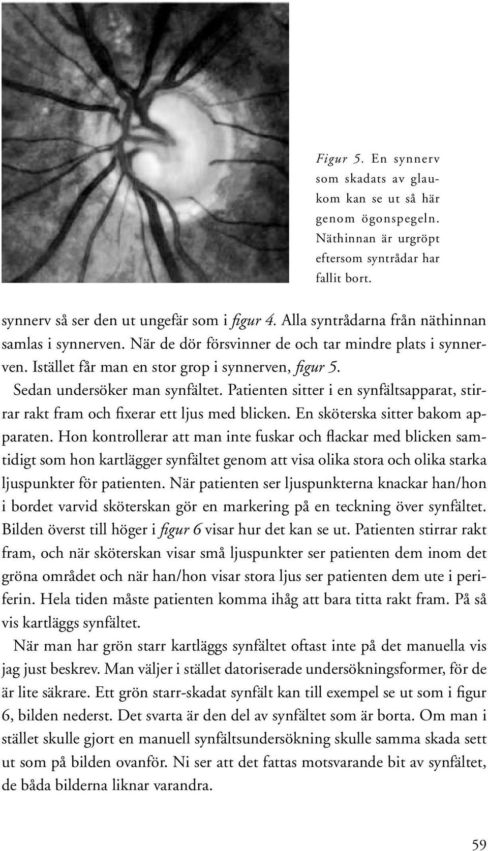 Patienten sitter i en synfältsapparat, stirrar rakt fram och fixerar ett ljus med blicken. En sköterska sitter bakom apparaten.
