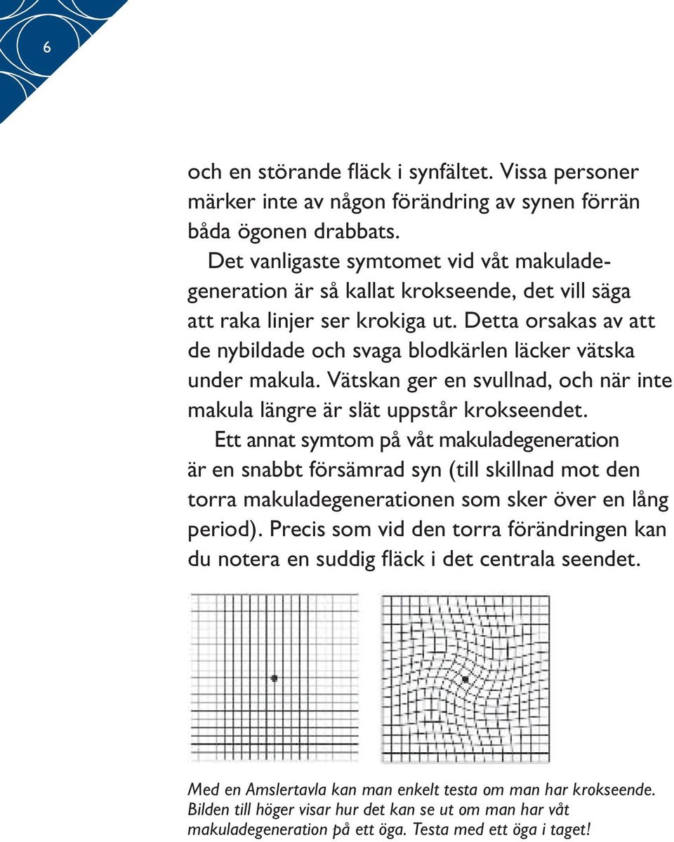 Detta orsakas av att de ny bildade och svaga blodkärlen läcker vätska under makula. Vätskan ger en svullnad, och när inte makula längre är slät uppstår krokseendet.