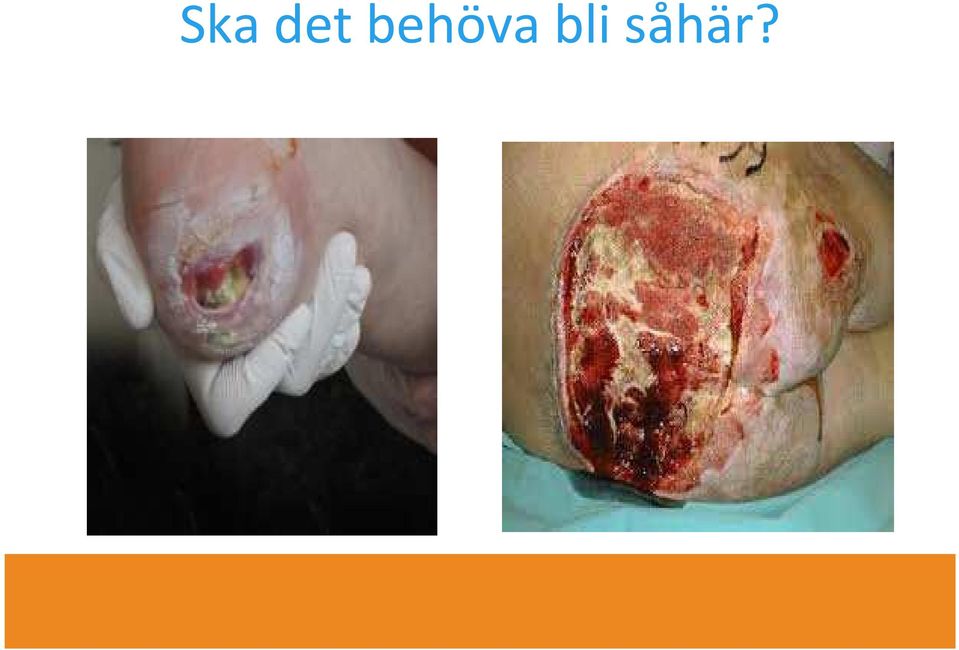 bli såhär?