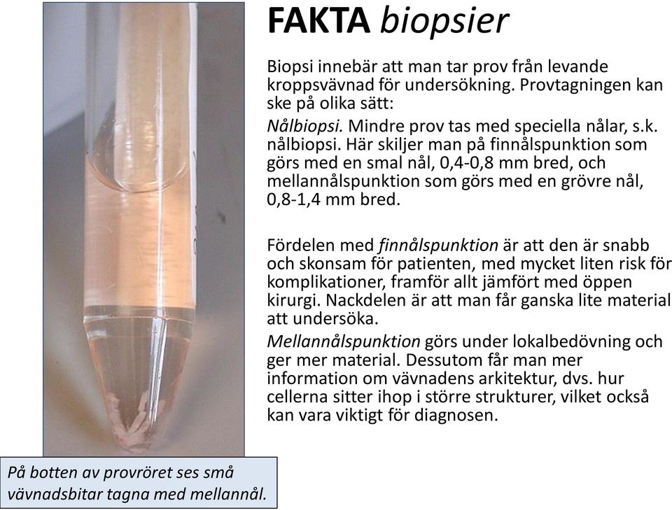 Fördelen med finnålspunktion är att den är snabb och skonsam för patienten, med mycket liten risk för komplikationer, framför allt jämfört med öppen kirurgi.