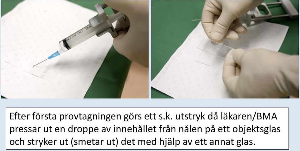 innehållet från nålen på ett objektsglas och