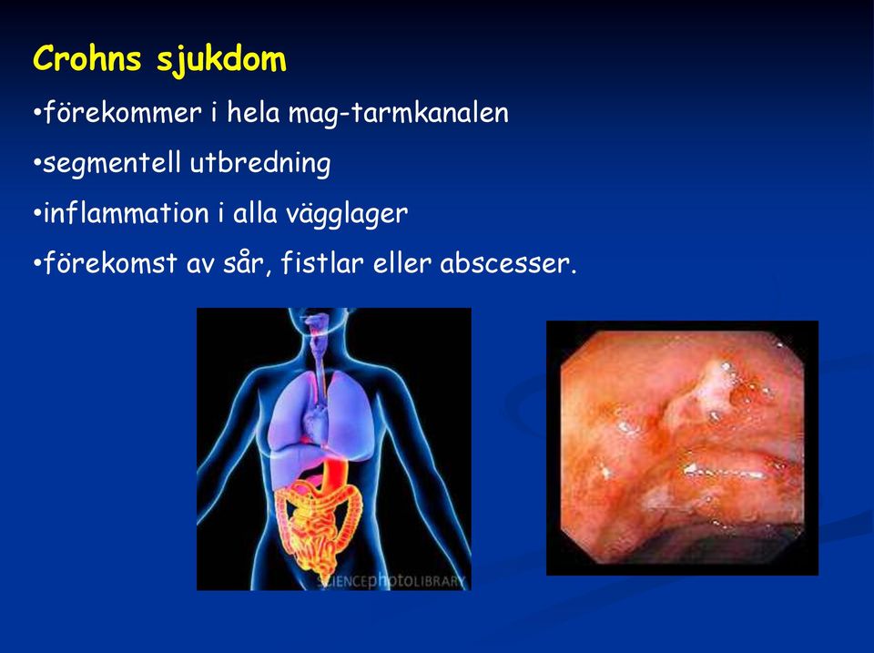 utbredning inflammation i alla