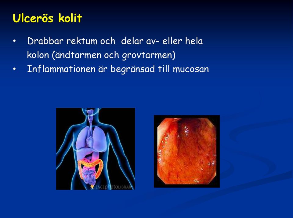 (ändtarmen och grovtarmen)