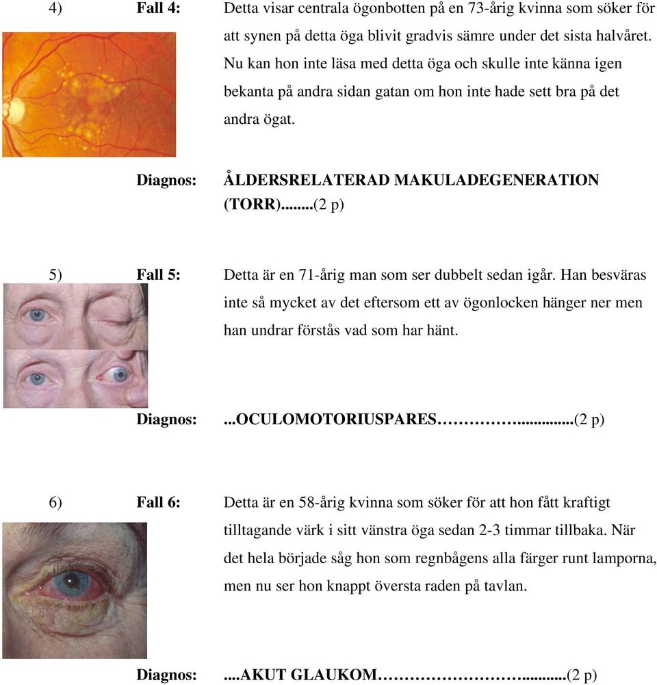 igår Han besväras inte så mycket av det eftersom ett av ögonlocken hänger ner men han undrar förstås vad som har hänt Diagnos: OCULOMOTORIUSPARES (2 p) 6) Fall 6: Detta är en 58-årig kvinna som söker